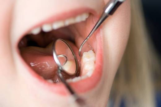 راهکار اساسی کاهش شاخص پوسیدگی دندان