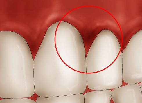 هر ۶ ماه يکبار به دندانپزشک مراجعه کنید