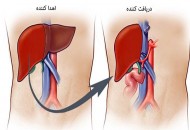 آنچه در مورد هپاتیت B و C باید بدانید