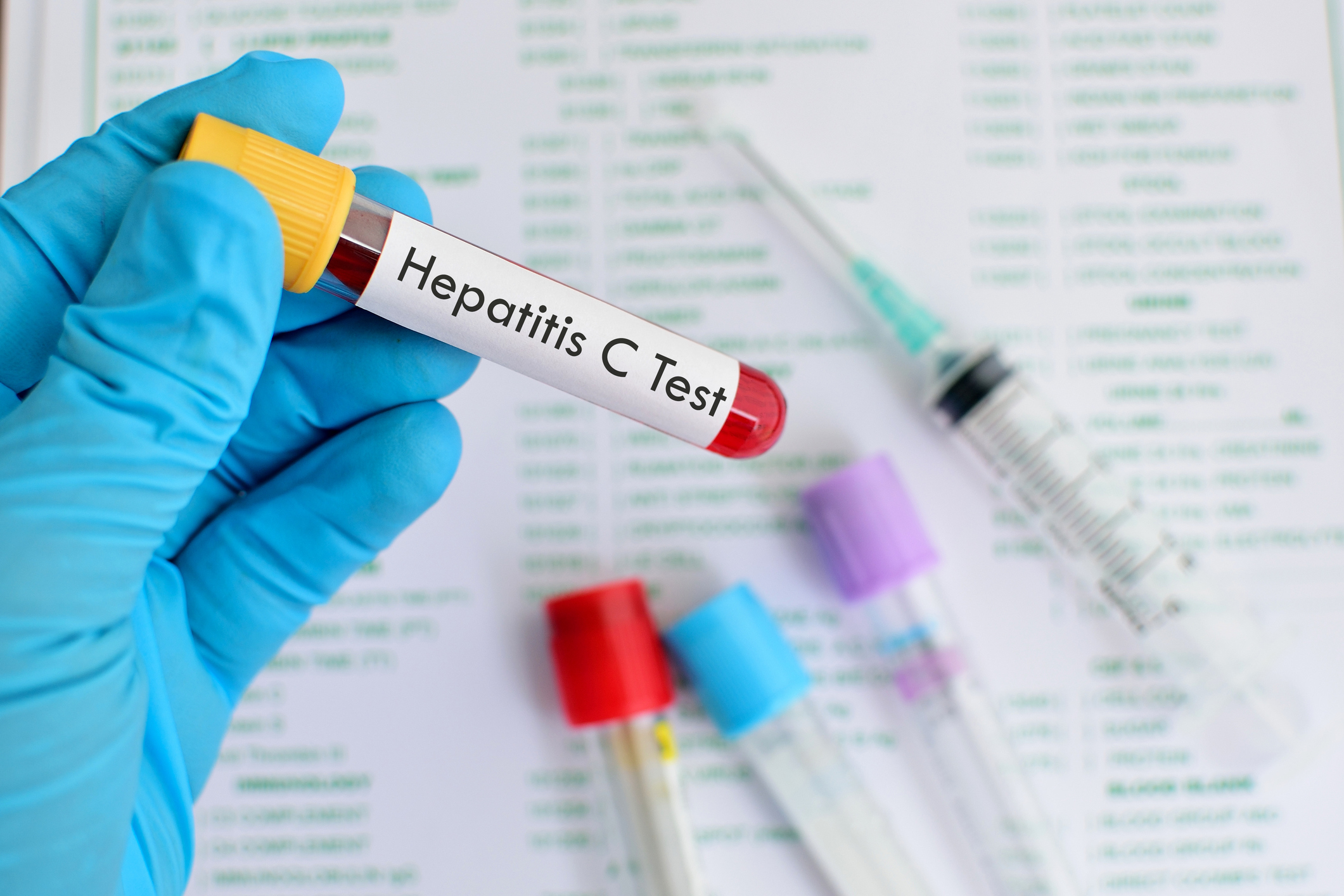 تولید داروهای ژنریک درمان قطعی هپاتیت C در شرایط تحریم